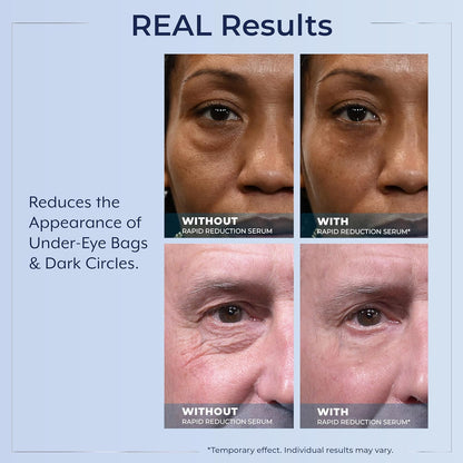 Plexaderm Rapid Reduction Serum - Visibly Reduces Under-Eye Bags & Wrinkles