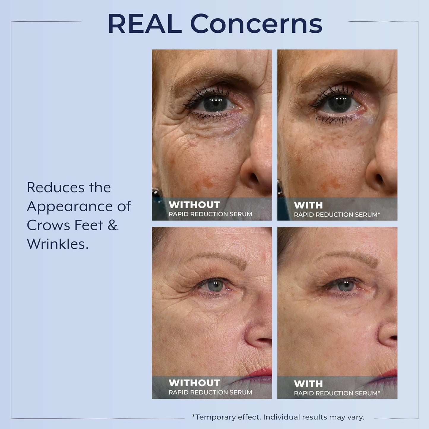 Plexaderm Rapid Reduction Serum - Visibly Reduces Under-Eye Bags & Wrinkles