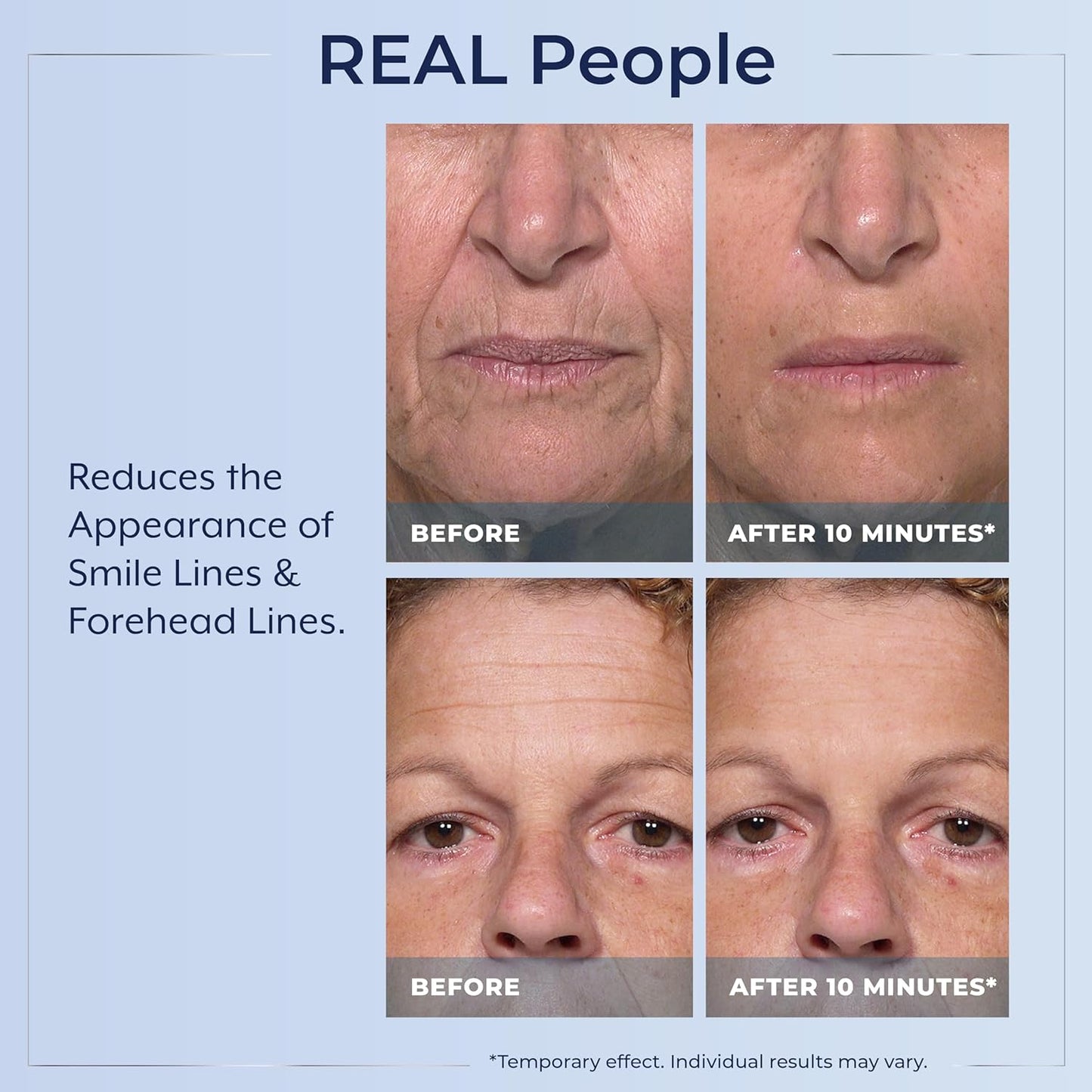 Plexaderm Rapid Reduction Serum - Visibly Reduces Under-Eye Bags & Wrinkles