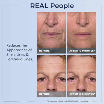 Plexaderm Rapid Reduction Serum - Visibly Reduces Under-Eye Bags & Wrinkles